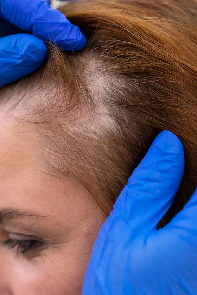 woman-getting-hair-loss-treatment-dermatologist