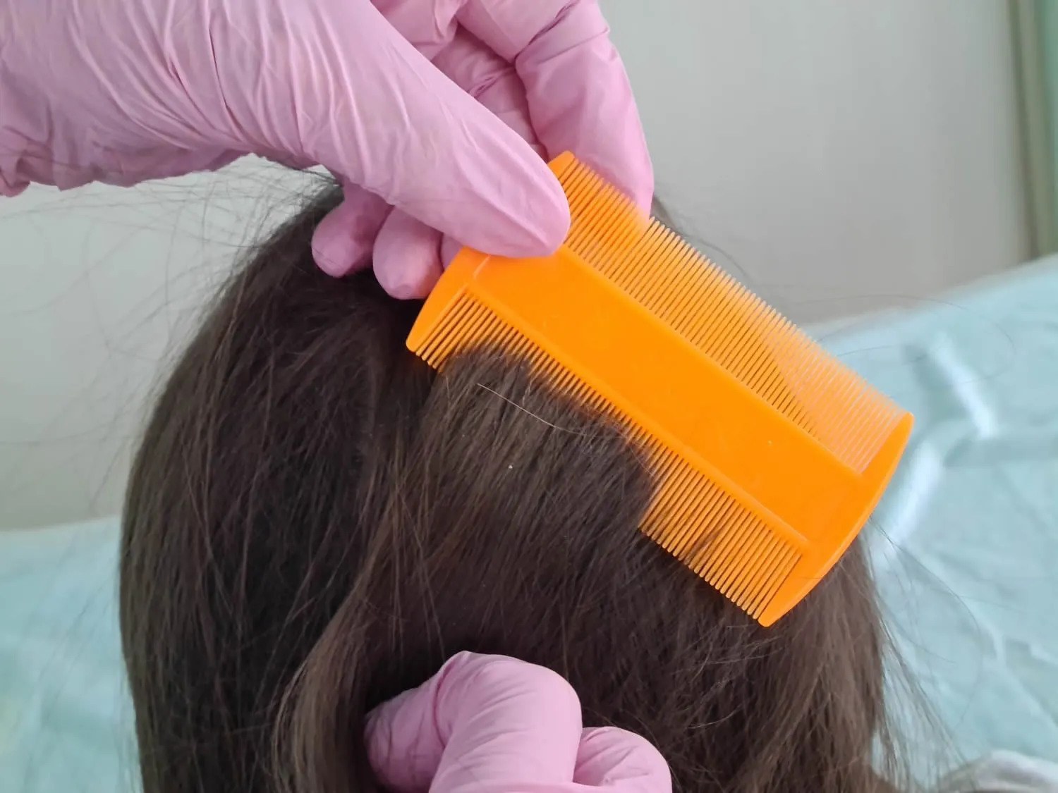 dermatologist uses lice comb little girl
